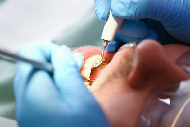 Best Emergency Treatment for Toothache in Memphis, TX