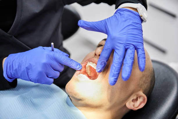 Best Emergency Broken Tooth Repair in Memphis, TX