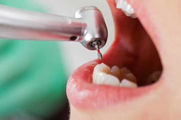 Best Weekend Emergency Dentist in Memphis, TX